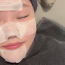 오빛나의원 | 여름철 불청객 삼총사 모공 + 블랙헤드 + 기미 지워버리기 프로젝트 | 아쿠아필 세안제 기미크림