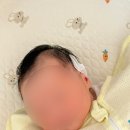 신생아 귀교정 강남세브란스 비용, 교정 후기