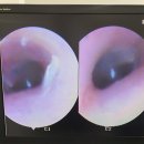 더 편한 보청기 이미지