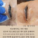 머리꽃 피우다 이미지