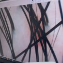 화성초록병원 | 화성 두피밥 화성시청점 / 지루성 두피 관리 / 하나하나 다 적어본 솔직 후기 Before &amp; After