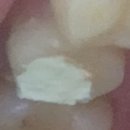 예인부부치과 이미지