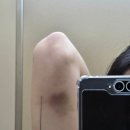 멍발란스 이미지