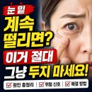 송탄성모안과의원 네이버블로그