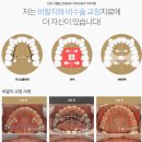 가이치과의원 네이버블로그