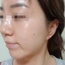 지온메디텍 | 피부탄력을 위한 뷰티디바이스, 듀얼소닉 지온메디텍 제품 후기