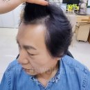 두안공구 | 여름에도 시원하고 가벼운 부산김호증모가발 이식증모술 영상