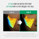 메카닉 | 기미패치 후기 :: 이지듀/닥터메카닉 크림 솔직 리뷰