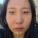 당정역로 | 군포가꾸는동안 순환관리 데콜테 림프관리 후기