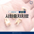 시화미소래치과의원 | 시화충치치료 단계에 맞는 치료를 받아주세요