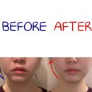 6234 | 더예쁠예정 철산점 솔직후기 광명 피부관리 철산 웨딩관리