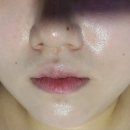 탈모락바이피부수작 네이버블로그
