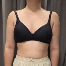 정우당바이오 제1공장 | 팔 부유방 지방흡입 한달차 | 전후비교 솔직후기 흉터부위, 바본관리