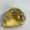 하이교정치과기공소 이미지