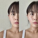 윤메디플러스 | 탄력 리프팅 끌어올리는 가정용 울쎄라 프롬메디 알파샷이펙터