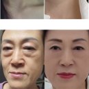 인셀덤블랙