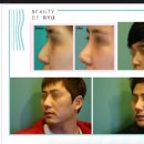화이트라인의원 티스토리
