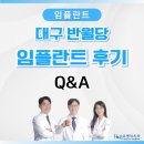 대구 반월당 임플란트를 고민하는 20대를 위한 후기