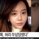 [박채경] 음주운전 교통사고..피해자 "몸 가누지 못할 정도" 이미지