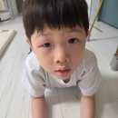 다온약국 | 🦟 다온이 눈두덩이 모기 물림, 소아과 다녀온 후기