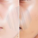 연세티트리의원 | T존 집중 관리 효과적인 아이템 선택법 알아보기