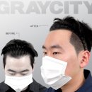 그레이시티 광주직영점 | 예약 필수인 이유 있는 대전탈모 관리 | 그레이시티 대전직영점 솔직 후기