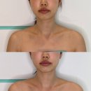 해운대 웨딩관리 고운빛깔 해운대점 온.다웨이브 테라피 윤곽관리 후기