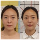 라라에스떼 | 예뻐지는 과정이 눈에 바로 보이는 라라에스떼에서 3회차 관리받고 왔어요.