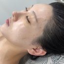 스킨델루나