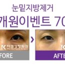 더코성형외과 이미지