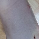 힘센병원 이미지