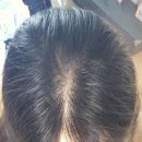 늘푸른자동차클리닉 | 상한머리 관리 맞춤 두피클리닉 샴푸 사용후기