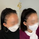 지성헤어라인