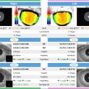 새롬안경원 이미지