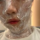 미드림의원 | 수원 편평사마귀 제거 미드림성형외과 후기