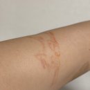 본 전 | (3회차)전 타투이스트가 타투 제거 받아본 후기/내돈내산