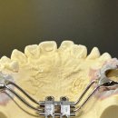 하이교정치과기공소 이미지