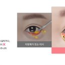 더나처럼성형외과의원 네이버블로그