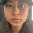 시청로2 | 광주신부관리 광주웨딩관리 상무지구신부관리 미엘멜로우 윤곽관리 후기