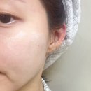 미백 앰플 추천 모공에도 좋은 코스텔지아 파트라씨 컨센트레이트 2주 사용후기