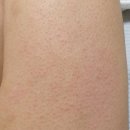 건조한 가을 저자극 각질제거 커피슈가 스크럽 | 닭살피부 관리템 추천! 자극없이 매끈매끈하게 관리가능한 ‘유케이스크럽’