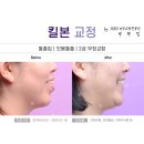 고성치과의원 네이버블로그