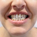 서울오름치과의원 이미지