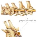 Limping: Causes of Lameness in Cats 이미지