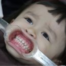 클리어(clear) 치과기공소 | 광주 교정치과 발품 후기 (광천동 터미널 주변)