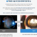 더블유안과의원 이미지