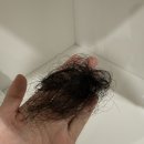 10통 | 산후탈모 - 려 루트젠 두피 에센스 내돈내산 120일간 10통 사용후기