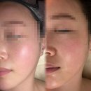 라비안 | 용인 동백 에스테틱 라비안스킨라인 용인 기흥구 등관리+피부관리 후기