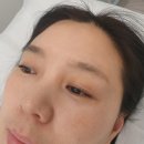 은뷰티 네이버블로그