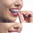 V라인S라인 이미지